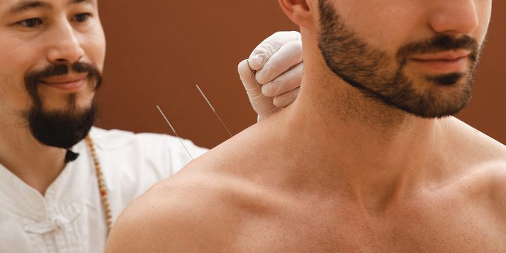 Acupuncture for Shoulder Pain Relief: 7 Tips for Clients to Manage