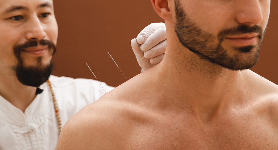 Needles for acupuncture for a man's shoulder pain